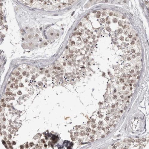 Immunohistochemical staining of human Te