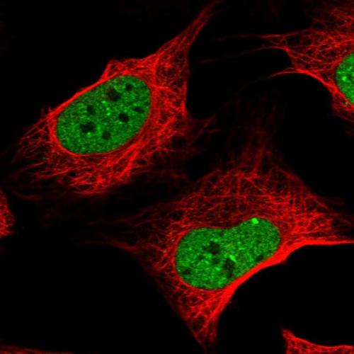 Immunofluorescent staining of human cell
