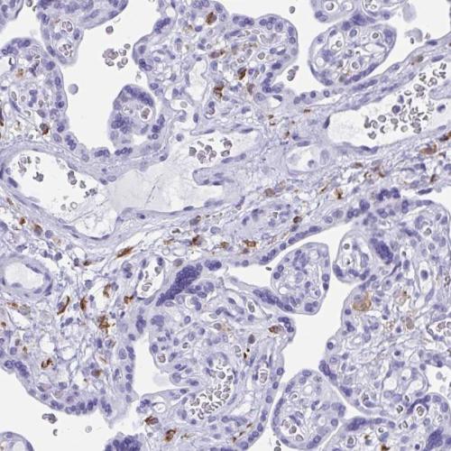 Immunohistochemical staining of human pl