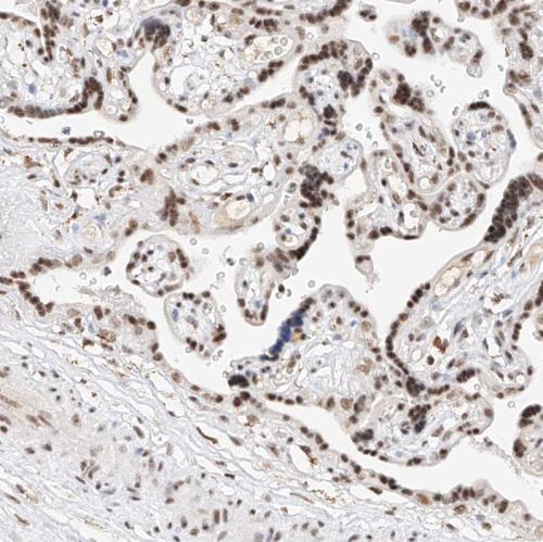 Immunohistochemical staining of human pl