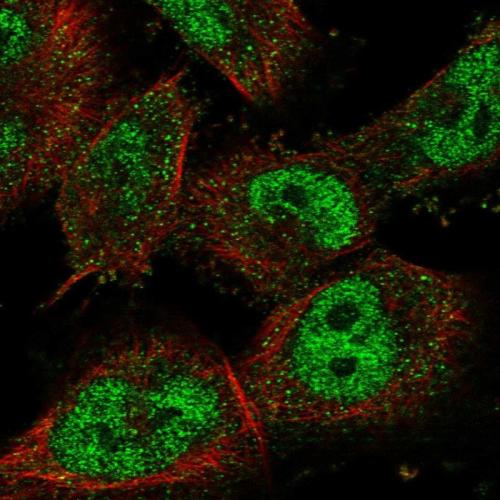 Immunofluorescent staining of human cell