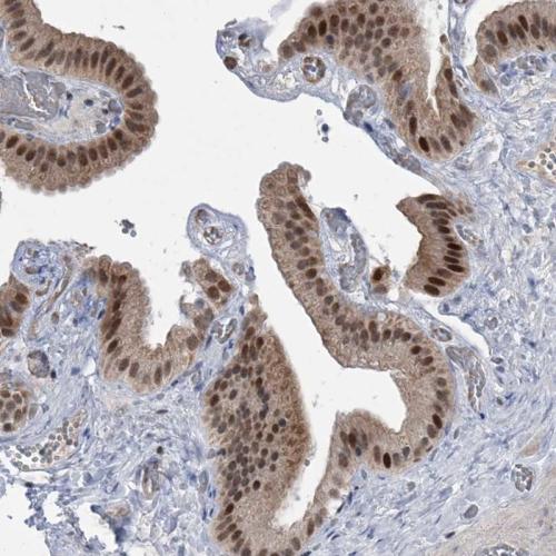 Immunohistochemical staining of human ga