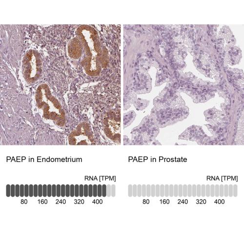 Immunohistochemistry analysis in human e