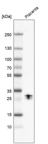 Western blot analysis in control (vector