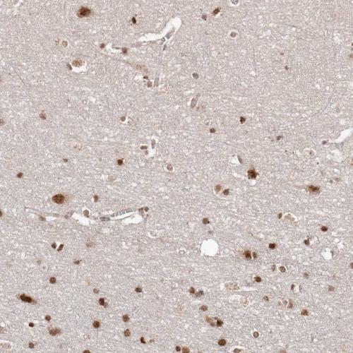 Immunohistochemical staining of human ce