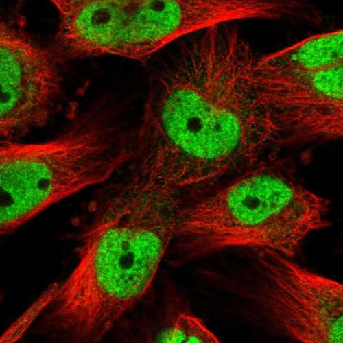 Immunofluorescent staining of human cell