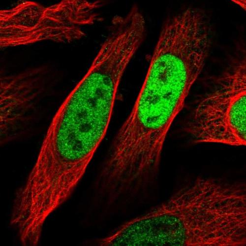 Immunofluorescent staining of human cell