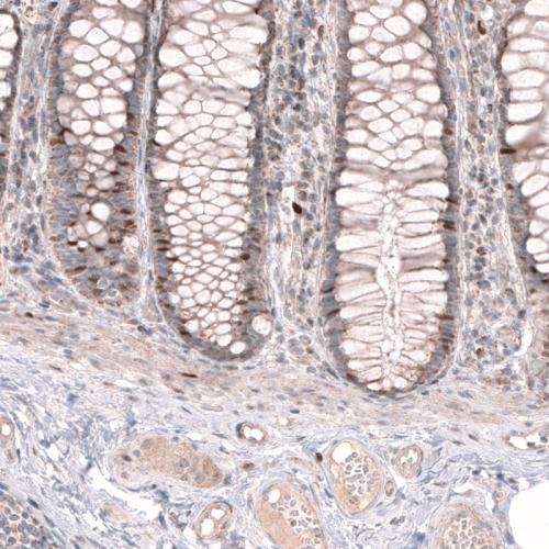 Immunohistochemical staining of human re