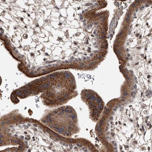 Immunohistochemical staining of human pl