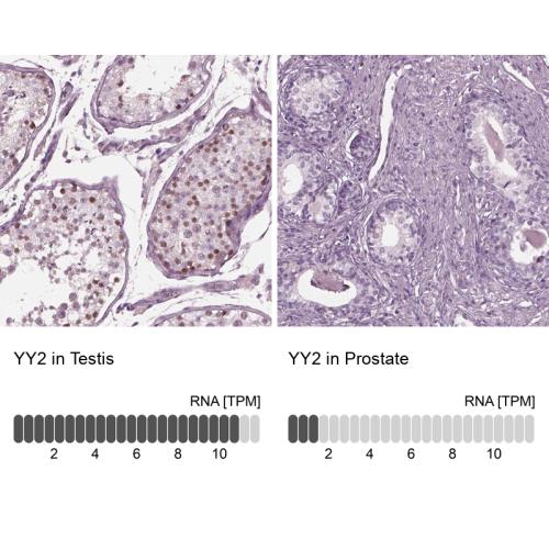 Immunohistochemistry analysis in human t