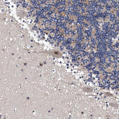 Immunohistochemical staining of human ce