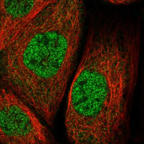 Immunofluorescent staining of human cell