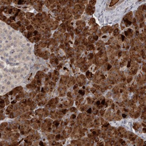 Immunohistochemical staining of human pa