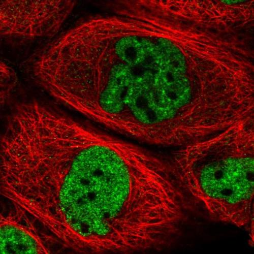 Immunofluorescent staining of human cell