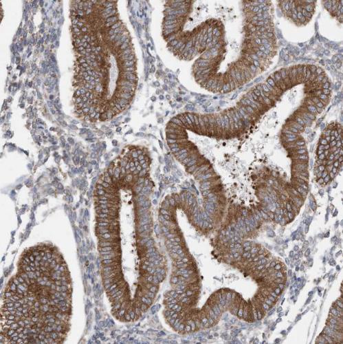 Immunohistochemical staining of human en
