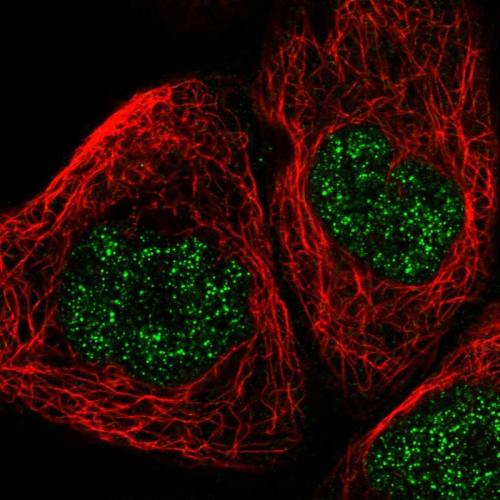 Immunofluorescent staining of human cell
