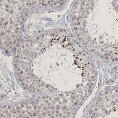 Immunohistochemical staining of human te