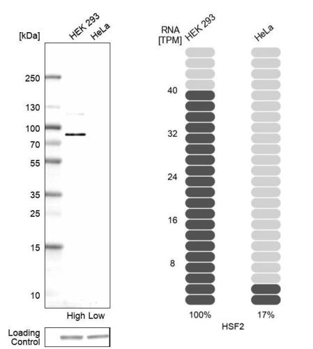 Western blot analysis in human cell line