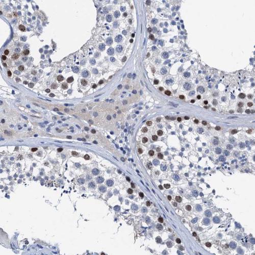 Immunohistochemical staining of human te