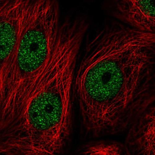 Immunofluorescent staining of human cell