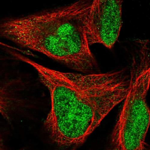 Immunofluorescent staining of human cell