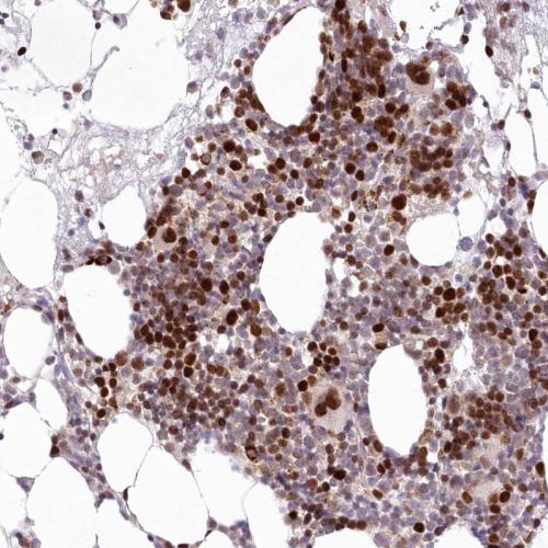 Immunohistochemical staining of human bo