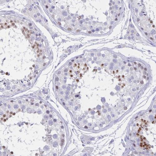 Immunohistochemical staining of human te
