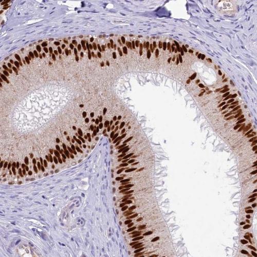 Immunohistochemical staining of human ep
