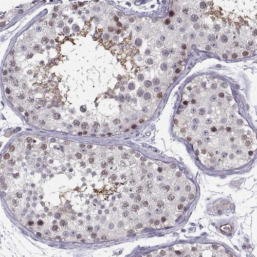 Immunohistochemical staining of human te