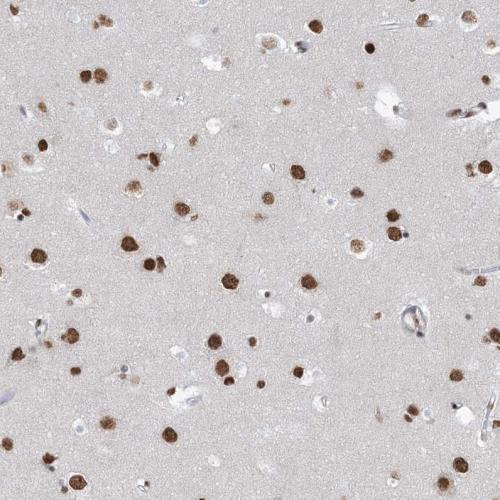 Immunohistochemical staining of human ce
