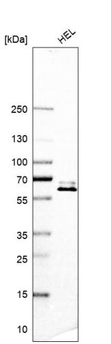 Western blot analysis in human cell line