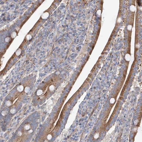 Immunohistochemical staining of human du