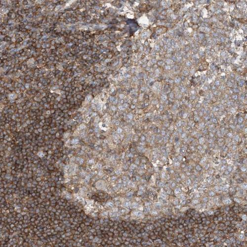 Immunohistochemical staining of human ap