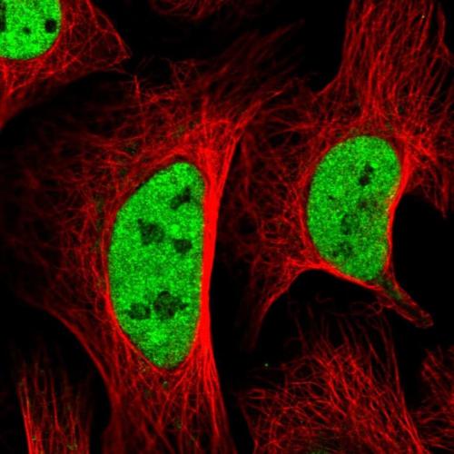 Immunofluorescent staining of human cell