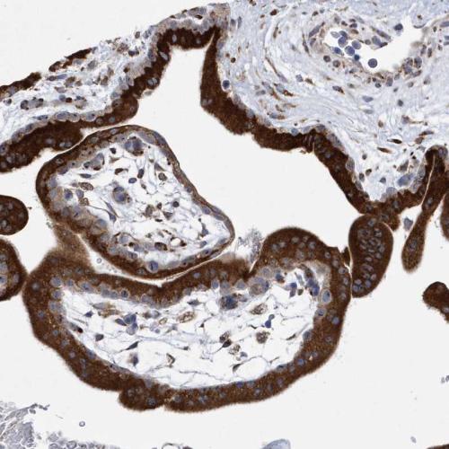 Immunohistochemical staining of human pl