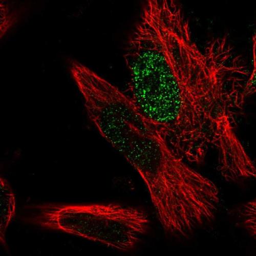 Immunofluorescent staining of human cell