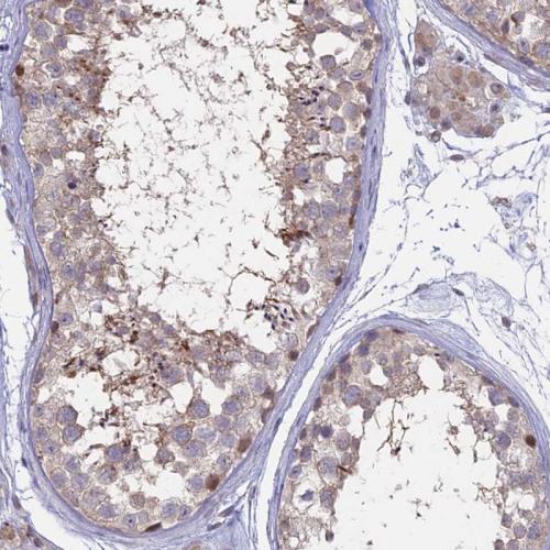 Immunohistochemical staining of human te