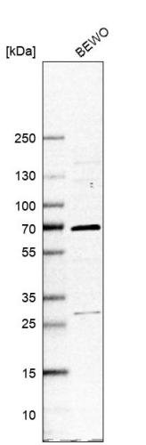 Western blot analysis in human cell line