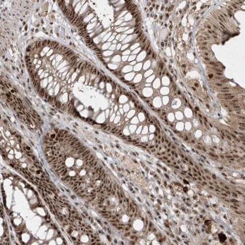 Immunohistochemical staining of human re