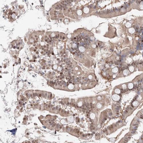 Immunohistochemical staining of human sm