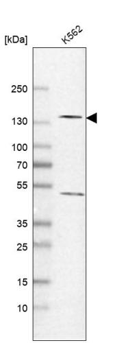 Western blot analysis in human cell line