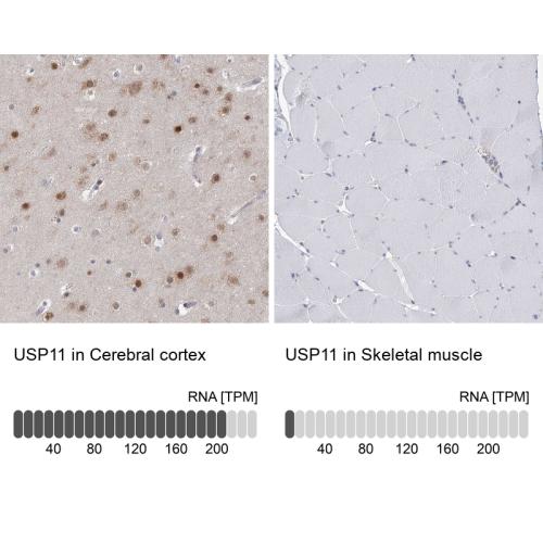 Immunohistochemistry analysis in human c