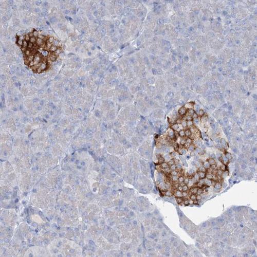 Immunohistochemical staining of human pa