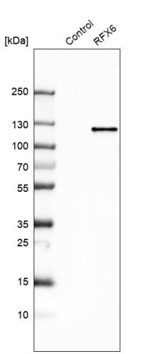 Western blot analysis in control (vector