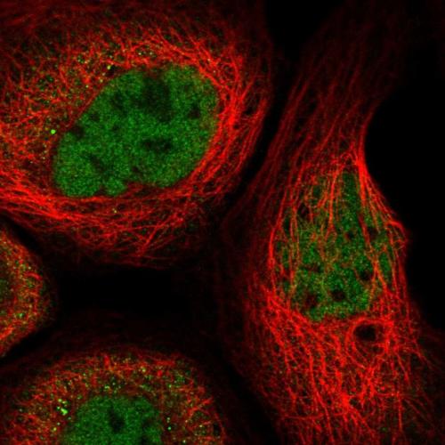 Immunofluorescent staining of human cell