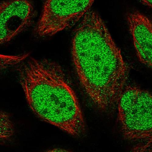 Immunofluorescent staining of human cell