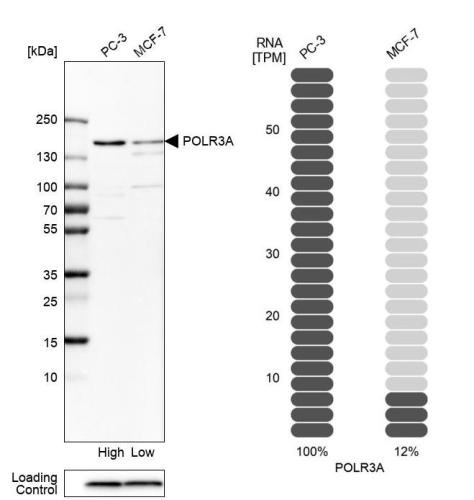 Western blot analysis in human cell line