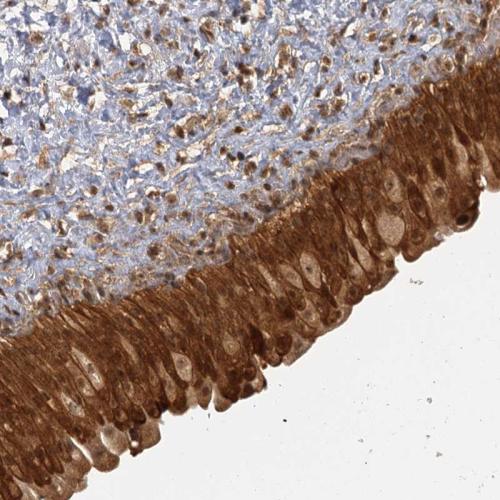 Immunohistochemical staining of human ur
