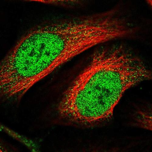 Immunofluorescent staining of human cell
