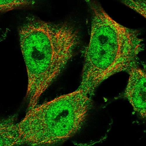 Immunofluorescent staining of human cell